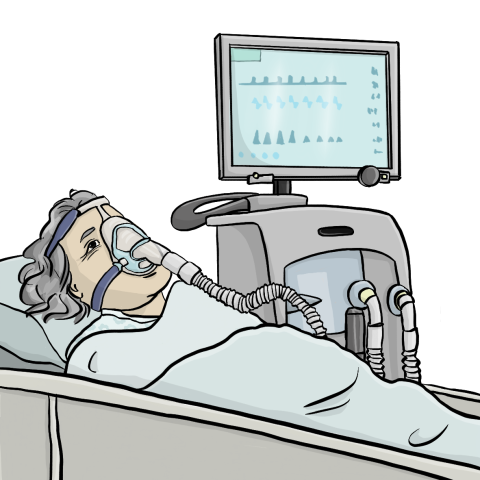 Eine ältere Frau ist an eine Beatmungsmaschine angeschlossen und wird von einem Monitor überwacht