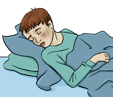 Ein Junge liegt krank im Bett. In seinem Gesicht sieht man einen Hautausschlag.